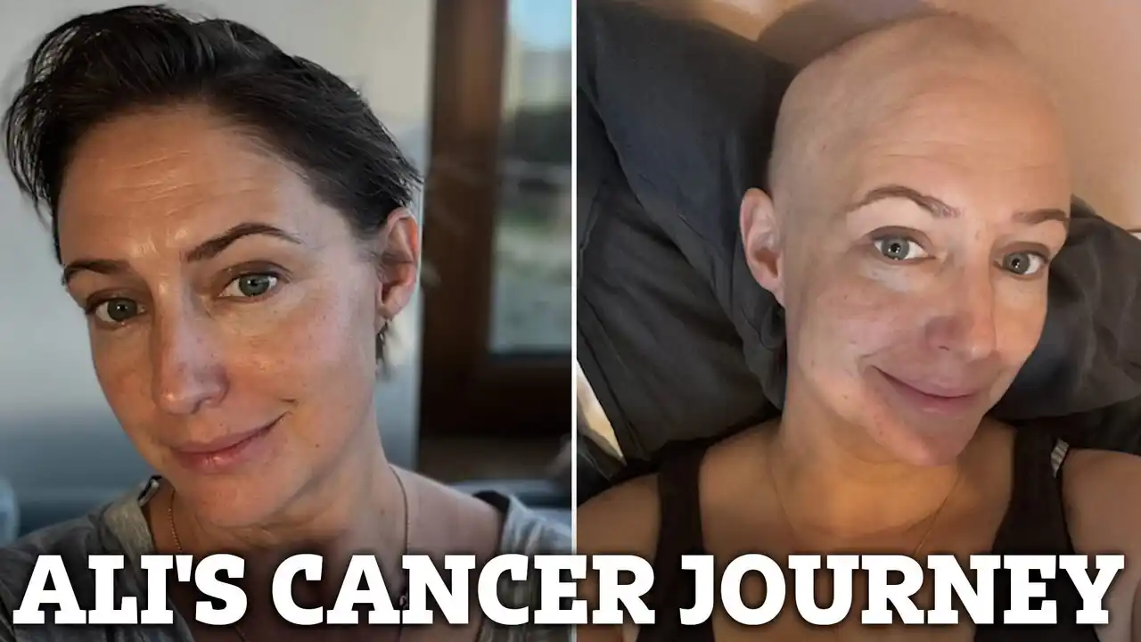 Hollyoaks star Ali Bastian shaves her head in emotional video amid ...